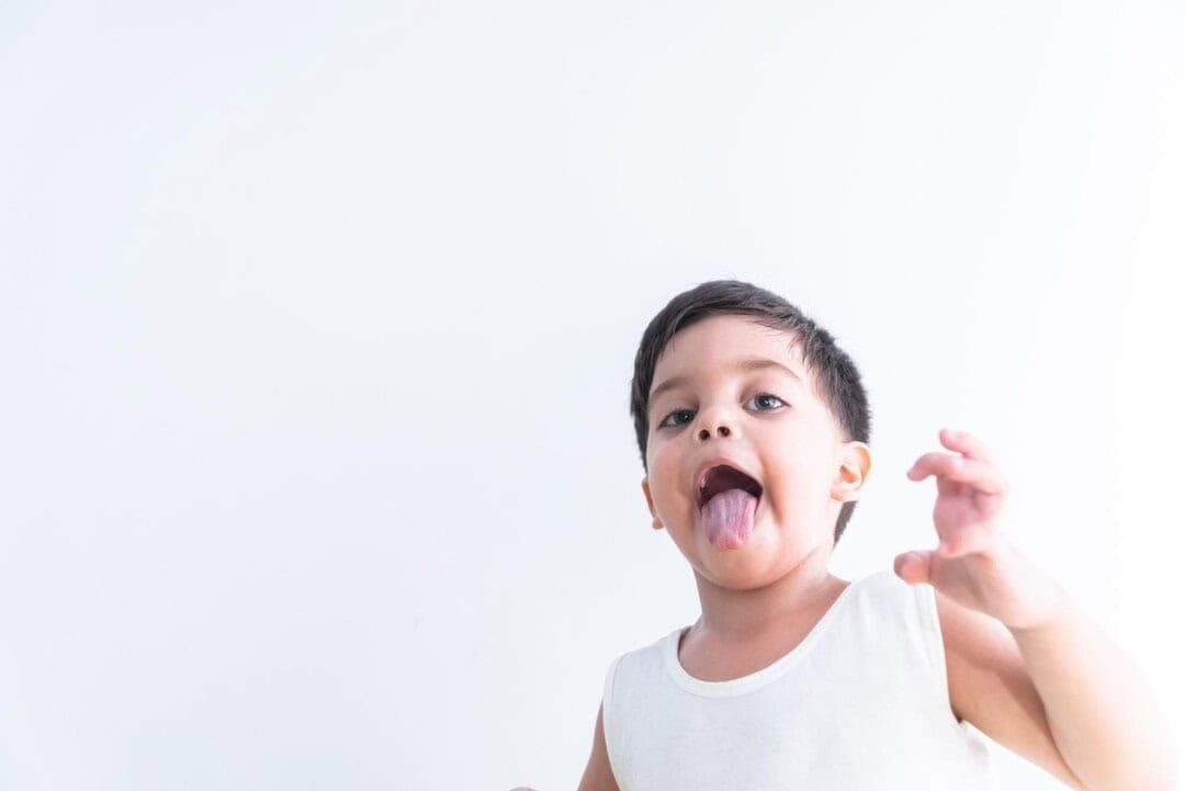 Bảo hiểm nhân thọ có chi trả cắt thắng lưỡi cho trẻ không?